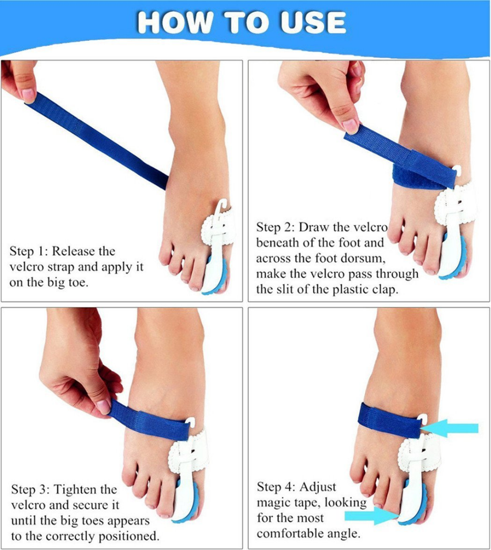 Fix Bunions With No Surgery Needed! Modern Kitchen Maker